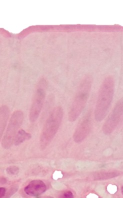 Enterozyten (Ileum)